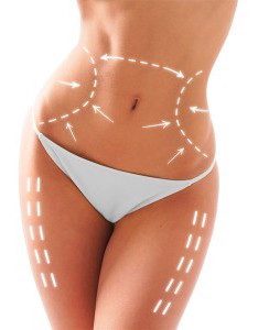 Best Liposuction Austin