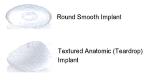 Breast Augmentation Fayetteville, Raleigh, NC