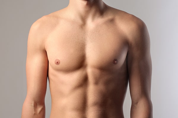 Gynecomastia Treatment