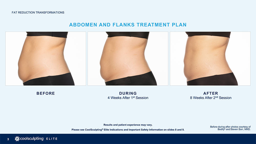 CoolSculpting® consultations are now available at Raleigh Plastic